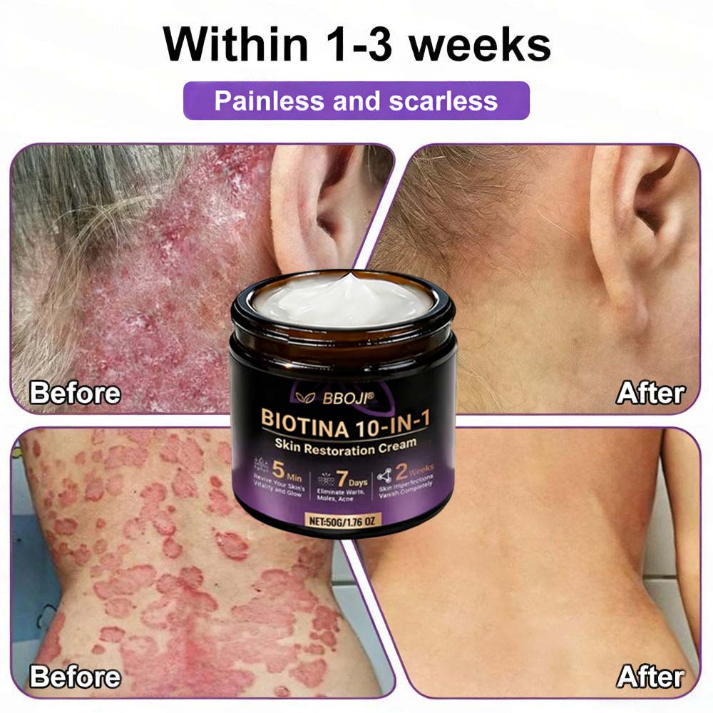 Product shipped from the USA ✨ Jorvian® 𝘽𝙞𝙤𝒕𝒊𝒏 10--𝘪𝘯-1 𝘚𝘬𝘪𝘯 𝘙𝘦𝘴𝘵𝘰𝘳𝘢𝘵𝘪𝑜𝑛 𝐶𝑟𝑒𝑎𝑚 🍀