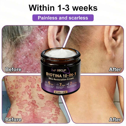 Product shipped from the USA ✨ Jorvian® 𝘽𝙞𝙤𝒕𝒊𝒏 10--𝘪𝘯-1 𝘚𝘬𝘪𝘯 𝘙𝘦𝘴𝘵𝘰𝘳𝘢𝘵𝘪𝑜𝑛 𝐶𝑟𝑒𝑎𝑚 🍀