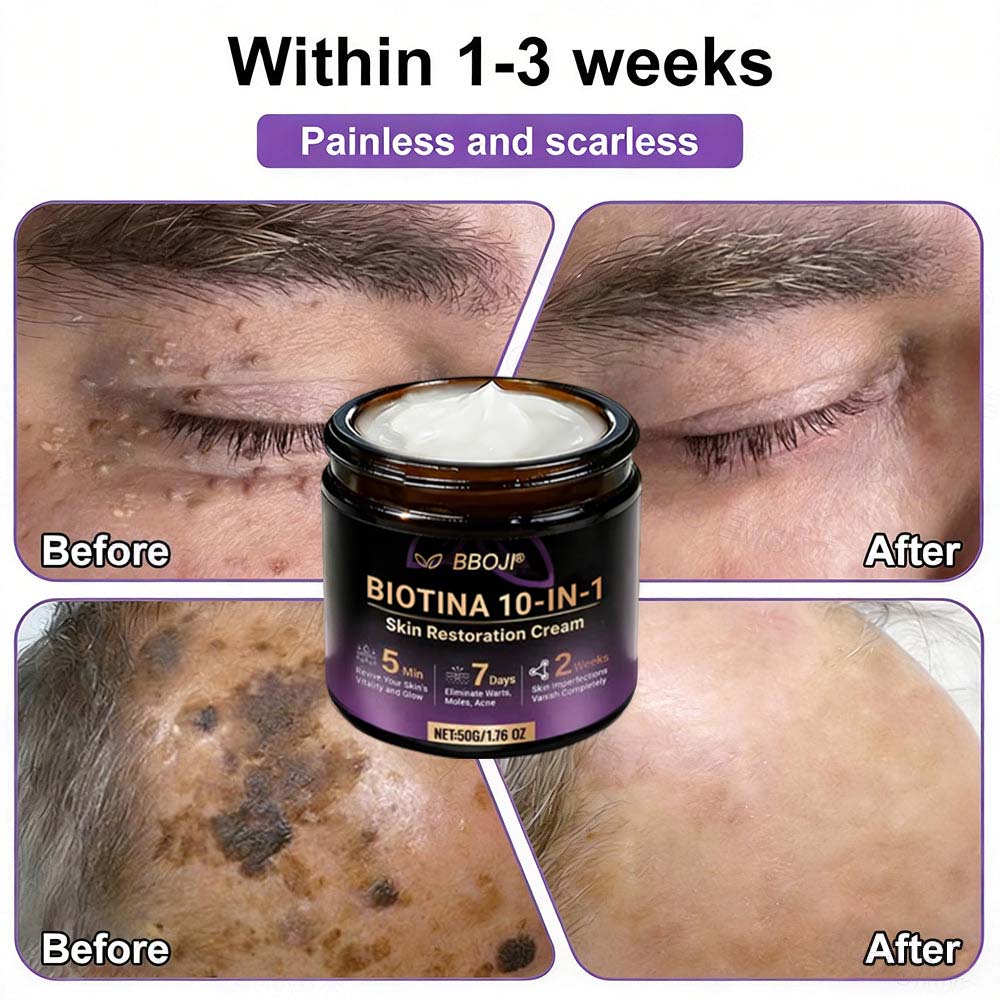 Product shipped from the USA ✨ Jorvian® 𝘽𝙞𝙤𝒕𝒊𝒏 10--𝘪𝘯-1 𝘚𝘬𝘪𝘯 𝘙𝘦𝘴𝘵𝘰𝘳𝘢𝘵𝘪𝑜𝑛 𝐶𝑟𝑒𝑎𝑚 🍀