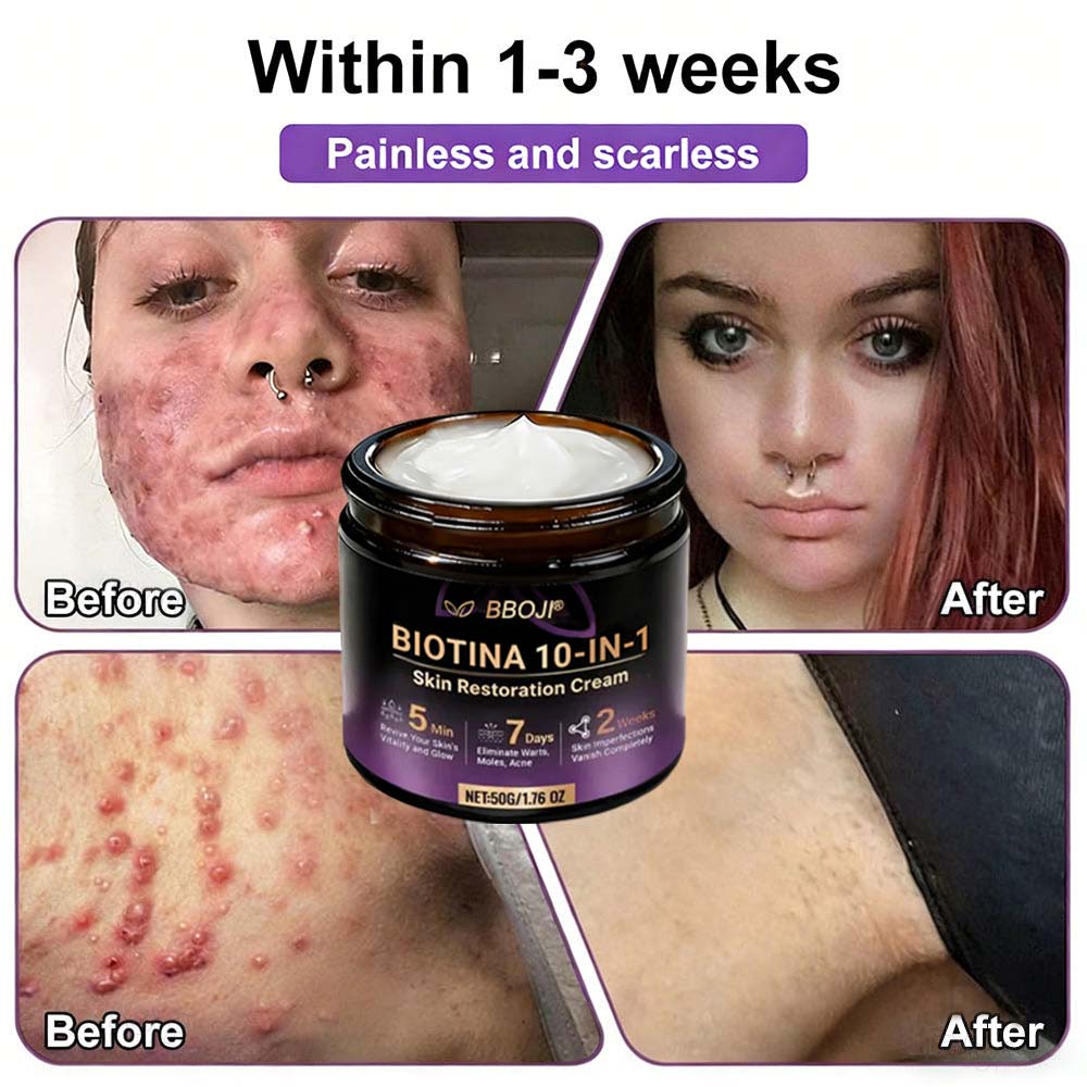 Product shipped from the USA ✨ Jorvian® 𝘽𝙞𝙤𝒕𝒊𝒏 10--𝘪𝘯-1 𝘚𝘬𝘪𝘯 𝘙𝘦𝘴𝘵𝘰𝘳𝘢𝘵𝘪𝑜𝑛 𝐶𝑟𝑒𝑎𝑚 🍀