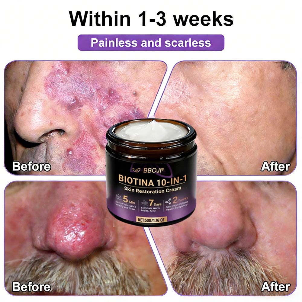 Product shipped from the USA ✨ Jorvian® 𝘽𝙞𝙤𝒕𝒊𝒏 10--𝘪𝘯-1 𝘚𝘬𝘪𝘯 𝘙𝘦𝘴𝘵𝘰𝘳𝘢𝘵𝘪𝑜𝑛 𝐶𝑟𝑒𝑎𝑚 🍀