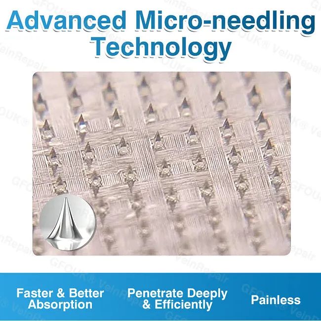 🇦🇺🏆✅️🏃GFOUK® VeinRepair Microneedle Patch Roll⚡Instant Relief, Long-Term Results