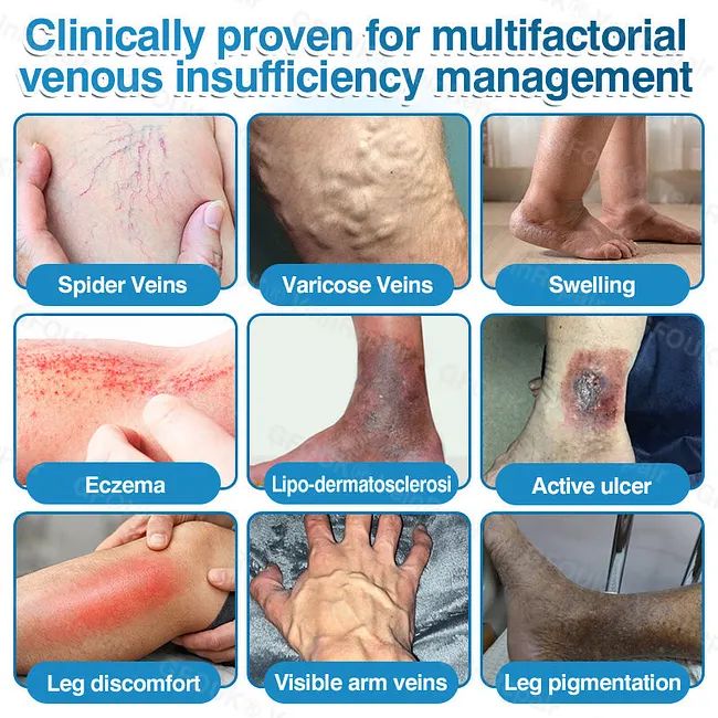 🇦🇺🏆✅️🏃GFOUK® VeinRepair Microneedle Patch Roll⚡Instant Relief, Long-Term Results